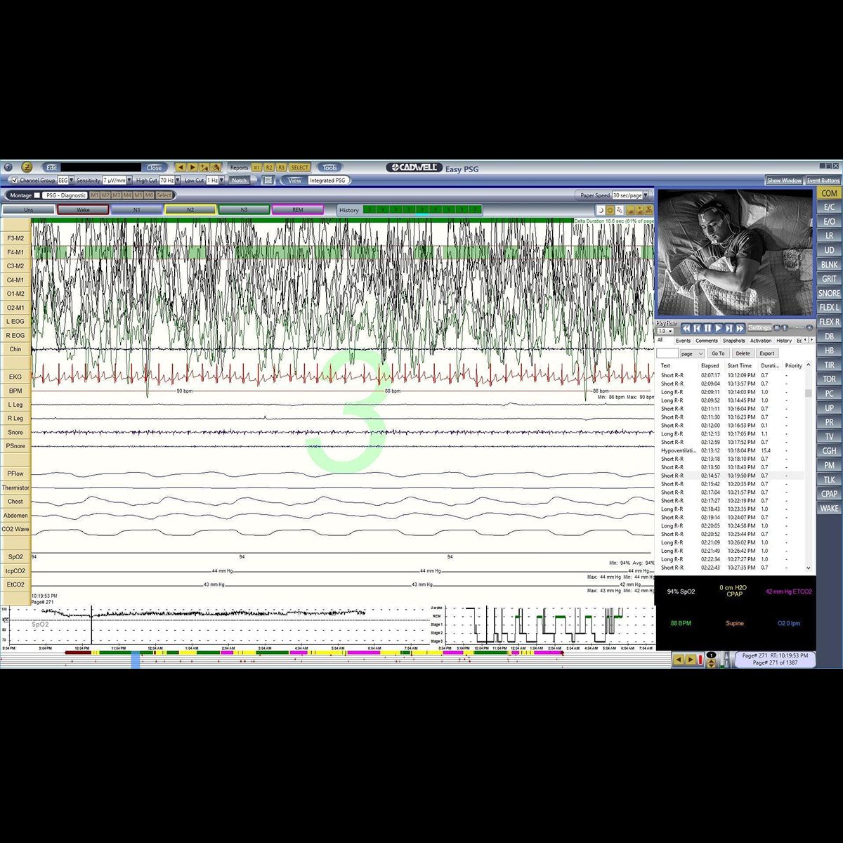 Software Easy III PSG