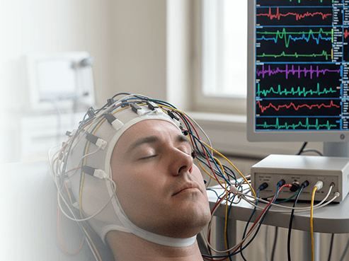 Electroencefalografía (EEG)