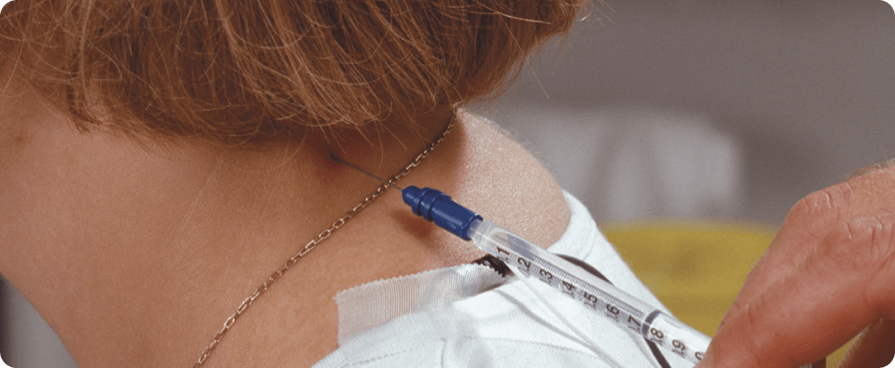 Aguja Neuroline Inoject vs Oxford Myoject: Estudio Clínico