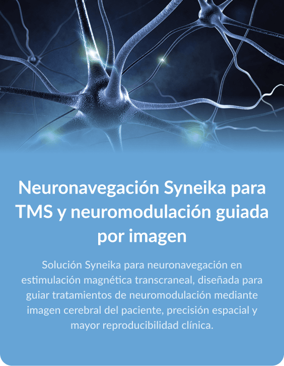 itemción