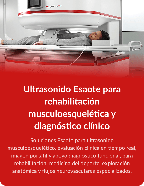 itemción
