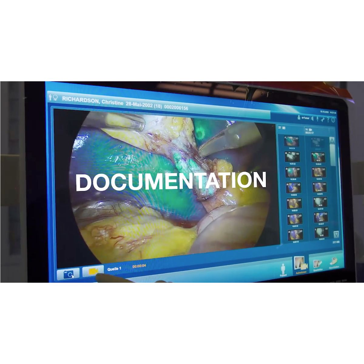 Quirófano inteligente OR1