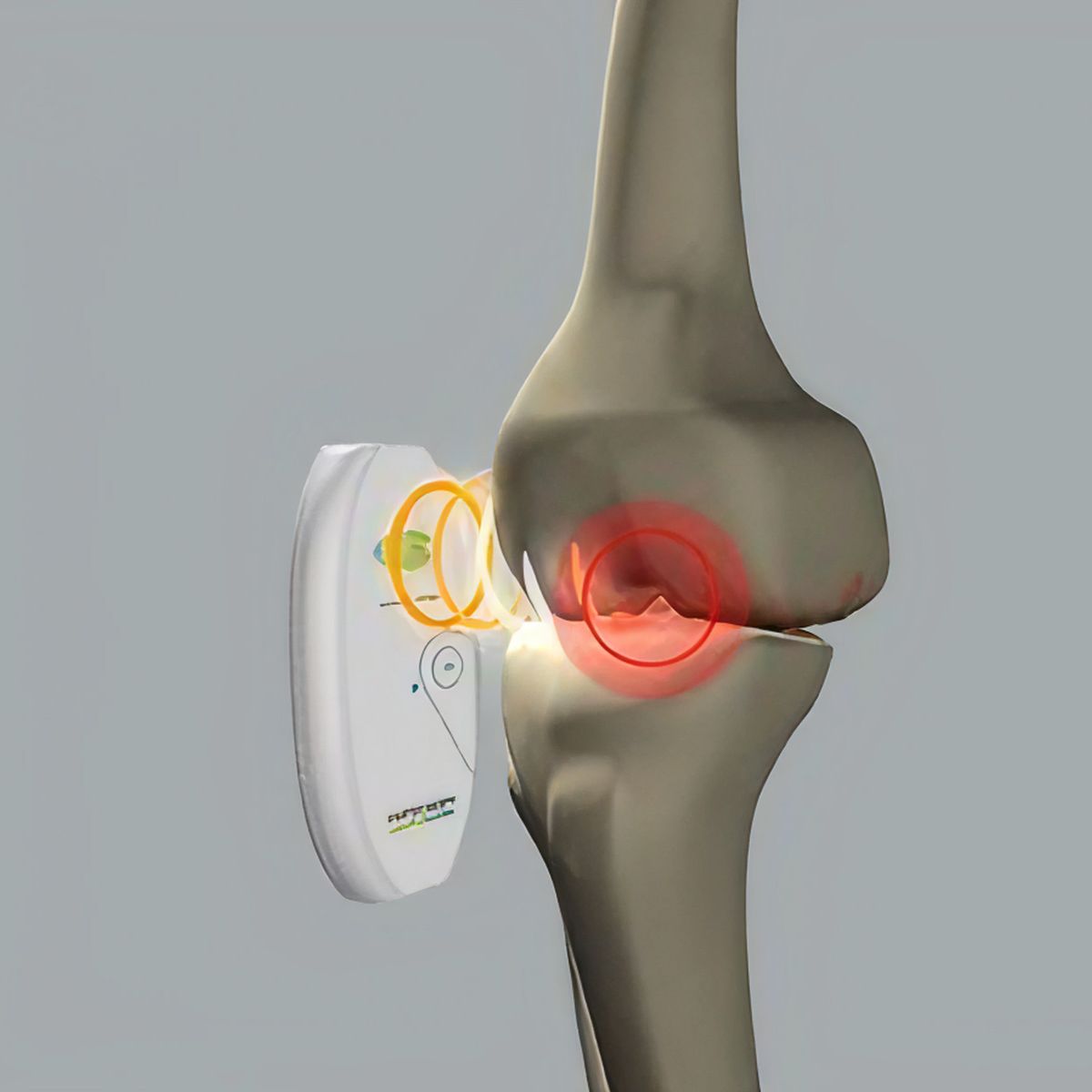 Magcell — Magnetoterapia portátil