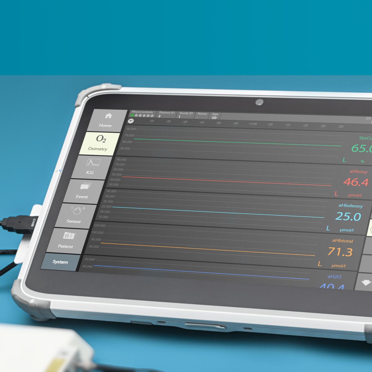 RheoLity — Plataforma de monitorización cerebral