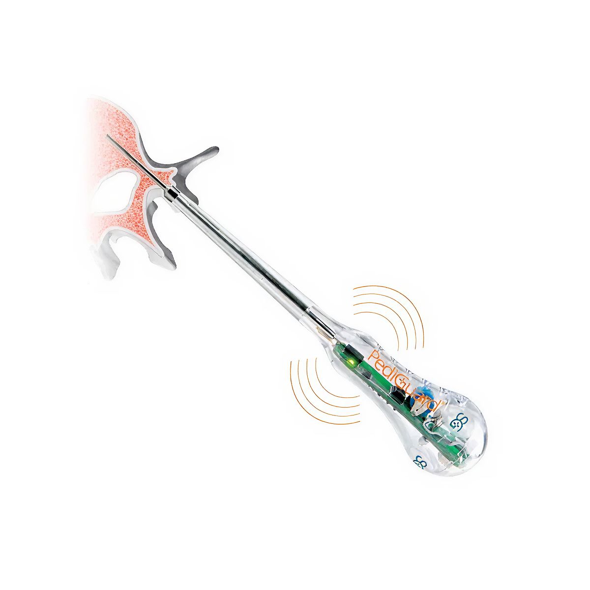Sonda DSG pedicular Straight