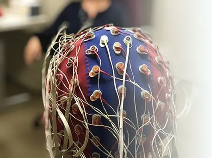 Estimulación del nervio vago transcutánea (VNS)