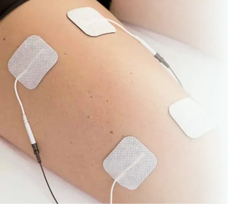 Consumibles para Monitoreo Neurofisiológico Intraoperatorio (IONM)