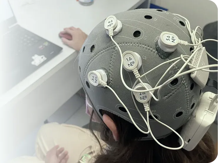 Consumibles para Neuromodulación