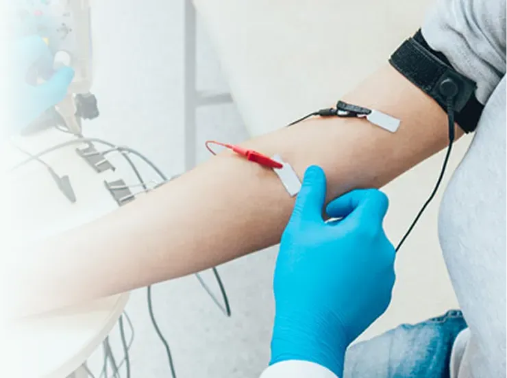 Estudios de conducción nerviosa (NCS)